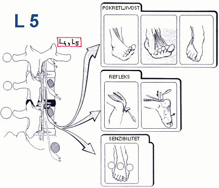 Prelom C3 vratnog pr�ljena